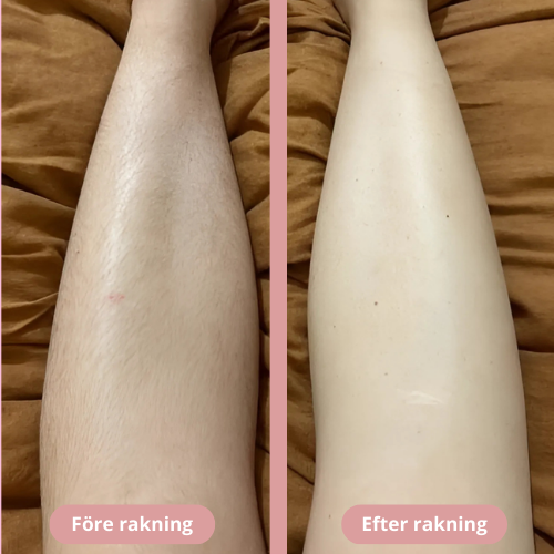 SmoothShave Pro - För Smidig & Smärtfri Rakning